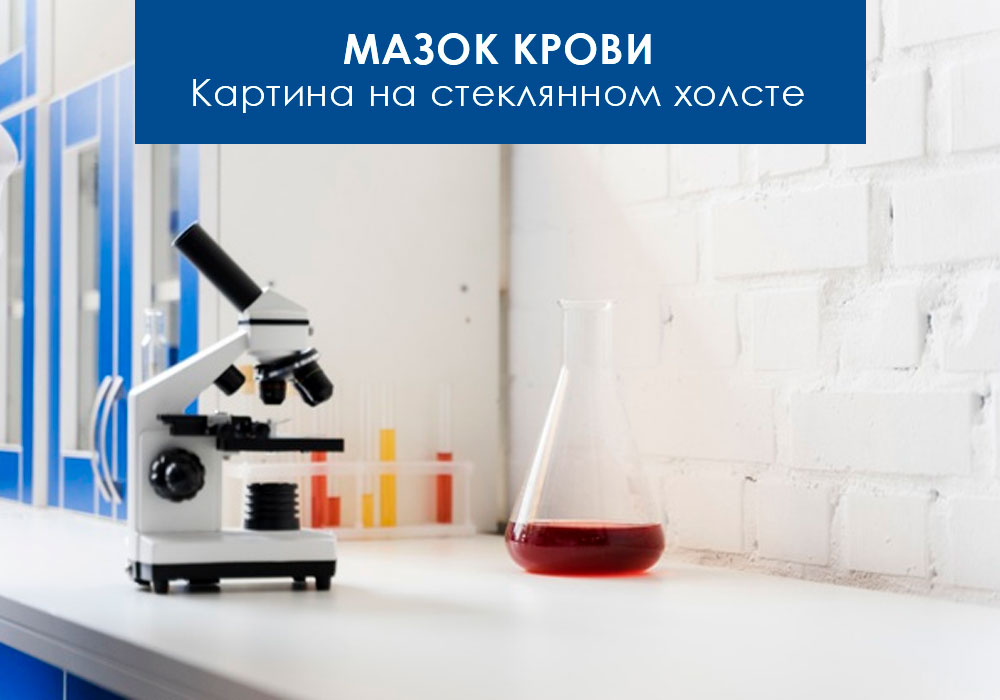 MAZOK-KROVI
